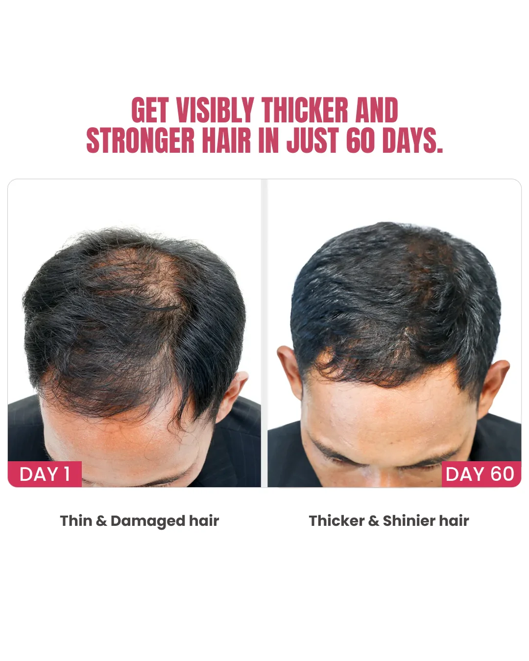 Biotin-Infused Hair Protein Mouthspray - Image 4