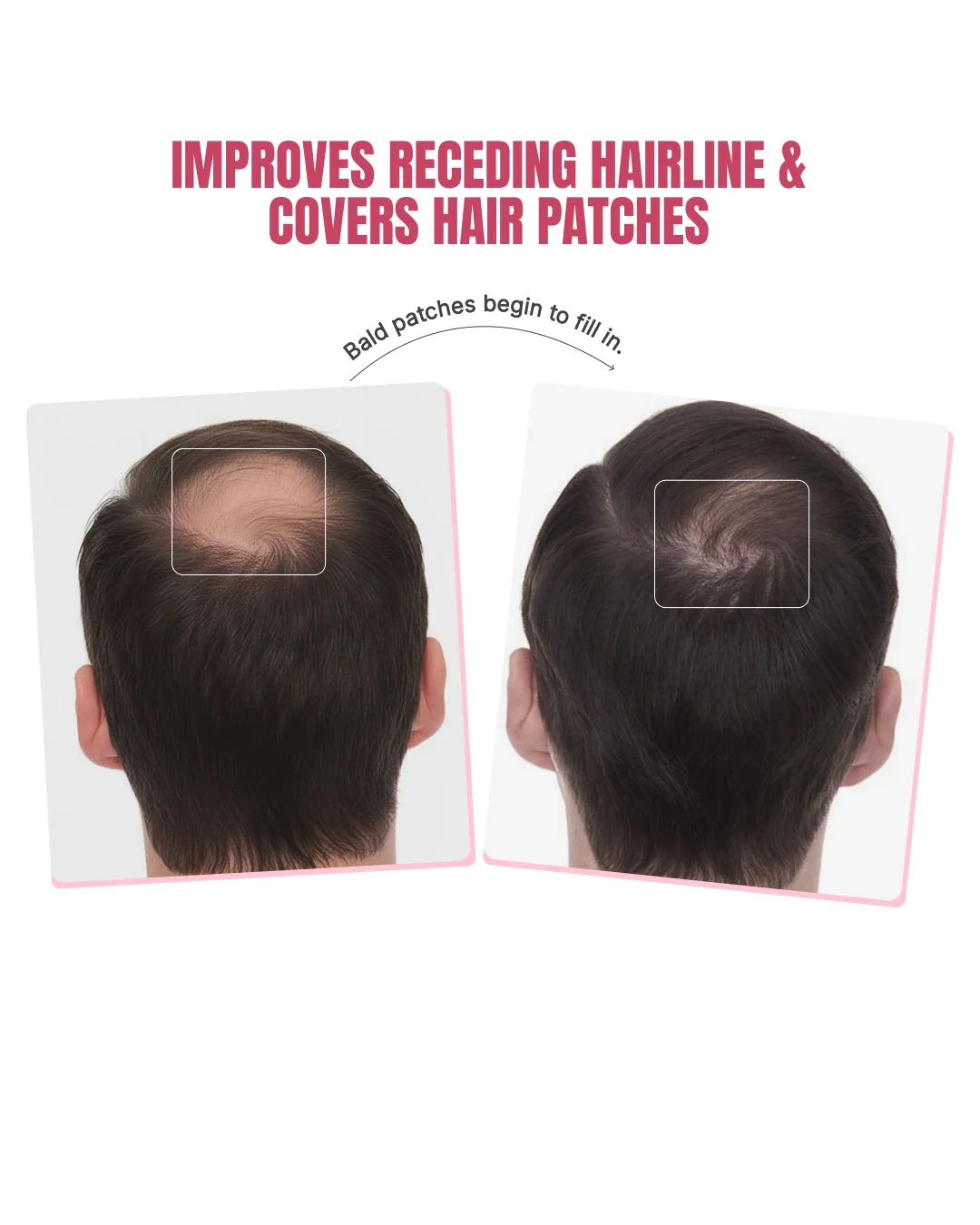 Biotin-Infused Hair Protein Mouthspray - Image 5