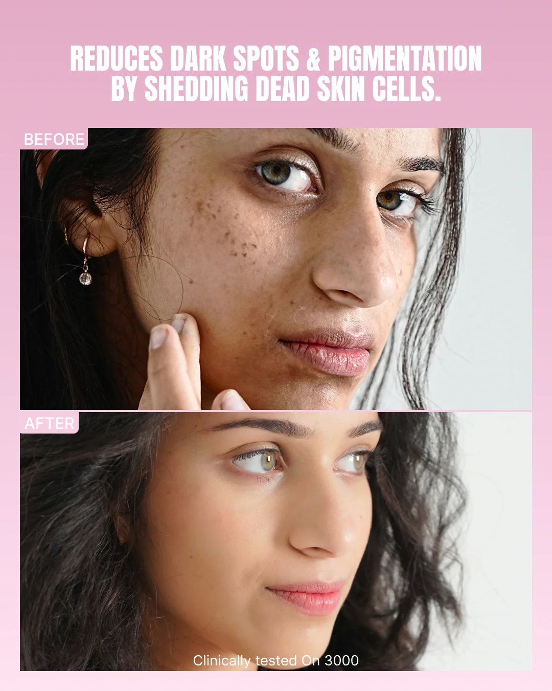 Intense Skin Brightening Glutathione-Mouthspray - Image 7