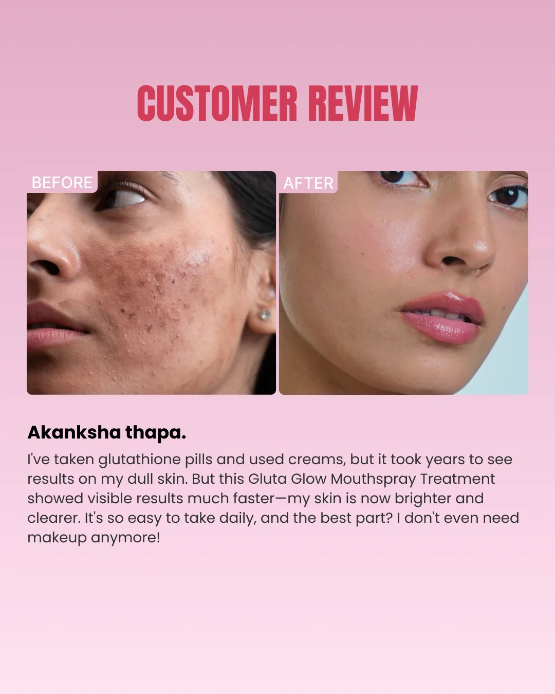 Intense Skin Brightening Glutathione-Mouthspray - Image 9