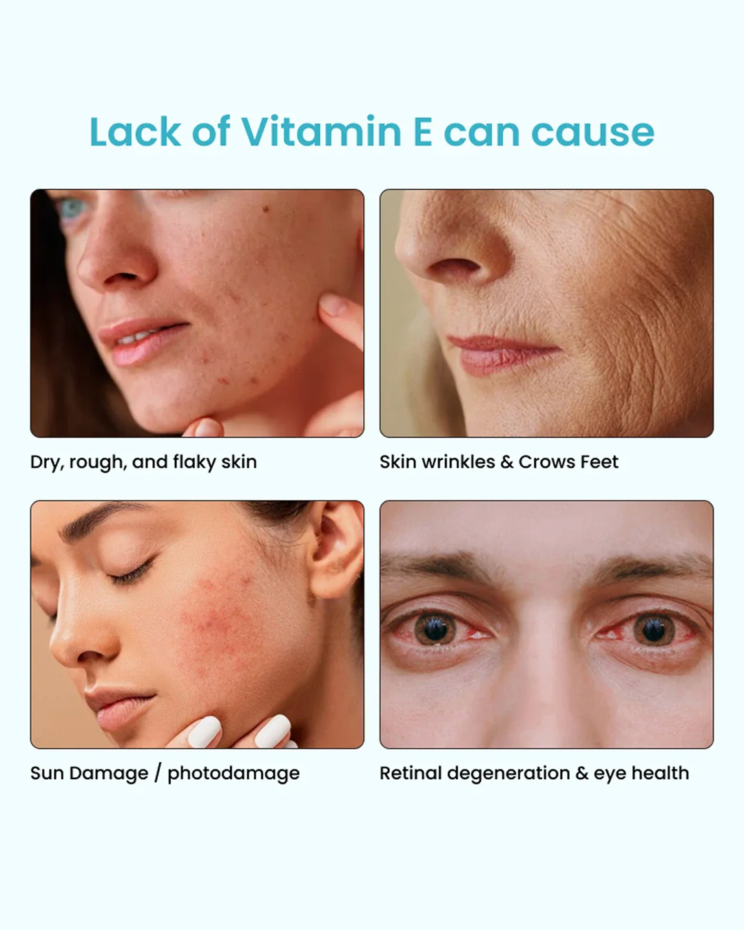Vitamin E Clear Skin Mouth Spray - Image 6